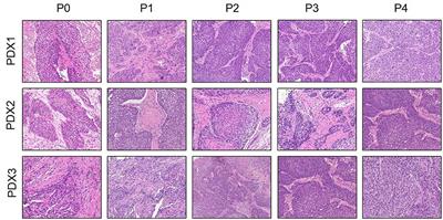 Anlotinib Combined With Chemoradiotherapy Exhibits Significant Therapeutic Efficacy in Esophageal Squamous Cell Carcinoma